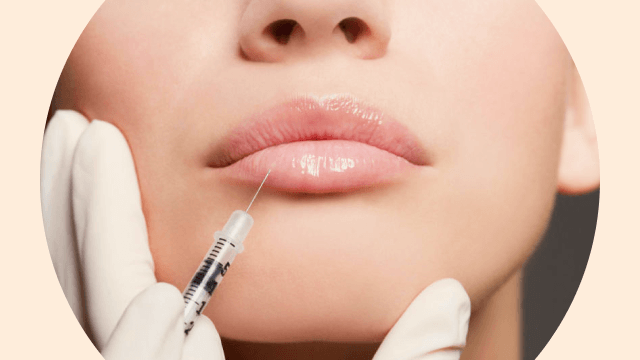 Injectari cu acid hialuronic - Dermato-estetica - Dana Derm - Centru de estetica faciala si remodelare corporala